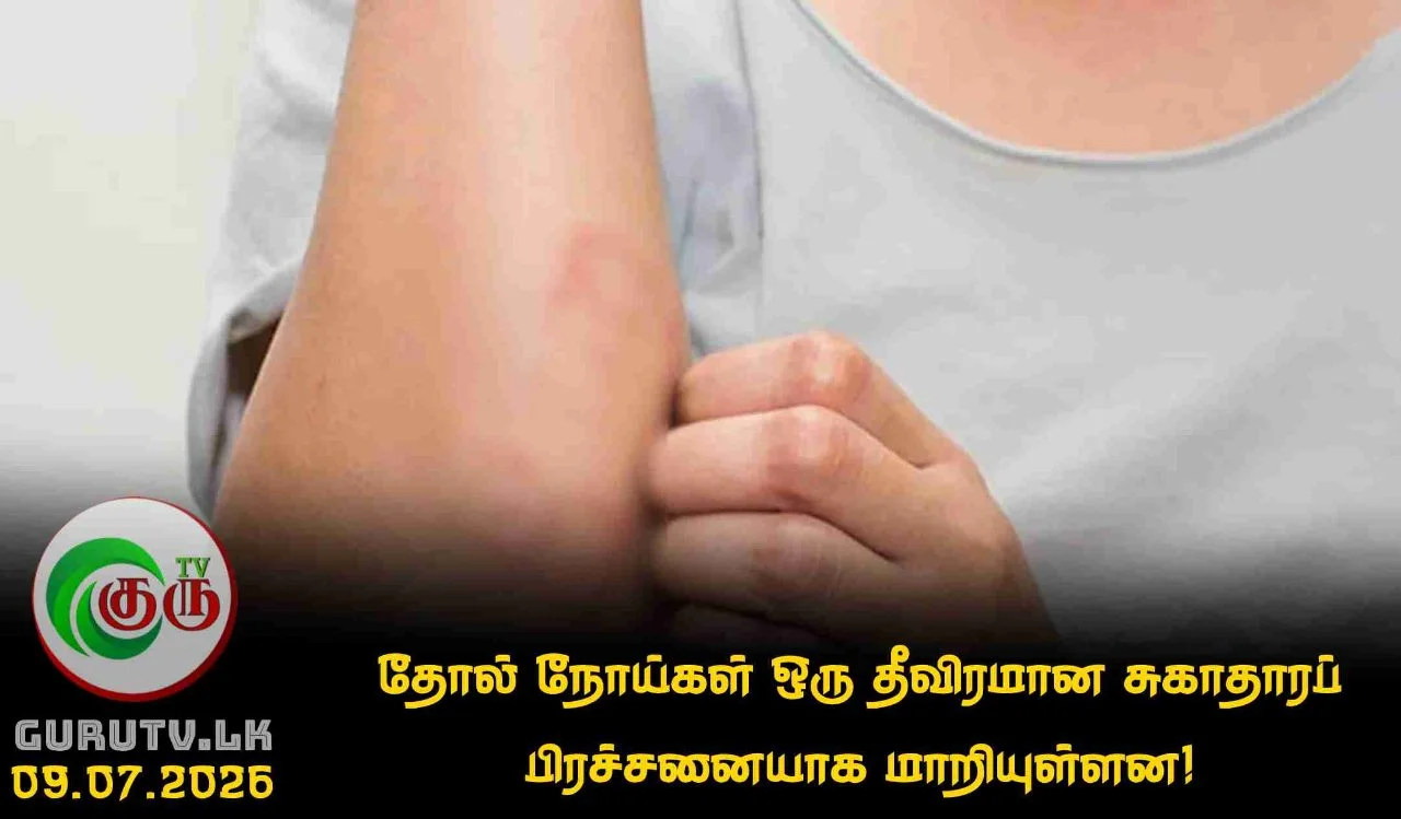 தோல் நோய்கள் ஒரு தீவிரமான சுகாதாரப் பிரச்சனையாக மாறியுள்ளன!